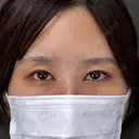 目頭切開 / その他（目元） ネビュラクリニック 京都院 AFTER サムネイル用