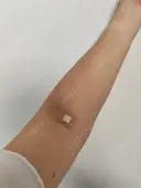 白玉点滴・注射 城本クリニック 大阪院 DAY 0 サムネイル用