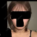 ボトックス（エラ・小顔） 札幌TAクリニック DAY 3 サムネイル用