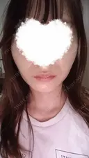 ボトックス（口角） DMTC CLINIC 日本橋院 DAY 0 サムネイル用