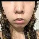 ルメッカ ルラ美容クリニック 岡山院 DAY 0 サムネイル用