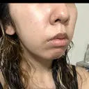 ルメッカ ルラ美容クリニック 岡山院 DAY 0 サムネイル用