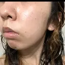 ルメッカ ルラ美容クリニック 岡山院 DAY 0 サムネイル用