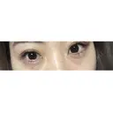 ヒアルロン酸注入（涙袋） 湘南美容クリニック 松山院 DAY 0 サムネイル用