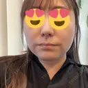 糸リフト BON BON CLINIC 銀座駅前本院 DAY 10 サムネイル用