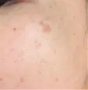 ルメッカ Clinic K Blossom DAY 2 サムネイル用