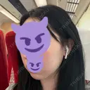 脂肪吸引（顔） / ボトックス（エラ・小顔） WOM CLINIC GINZA （ワム クリニック ギンザ） DAY 27 サムネイル用