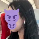 脂肪吸引（顔） / ボトックス（エラ・小顔） WOM CLINIC GINZA （ワム クリニック ギンザ） DAY 27 サムネイル用