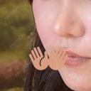 鼻尖形成（切開） / 軟骨移植 / 鼻修正 / 鼻柱下降・鼻唇角形成（猫手術） 東京シンデレラ美容外科 池袋院 DAY 254 サムネイル用