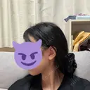 脂肪吸引（顔） / ボトックス（エラ・小顔） WOM CLINIC GINZA （ワム クリニック ギンザ） DAY 31 サムネイル用