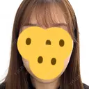 糸リフト / 脂肪吸引（顔） / ジョールファット除去 RIVER CLINIC（リバークリニック） AFTER サムネイル用