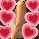 脂肪吸引（二の腕） / 脂肪溶解注射（二の腕） THE SKINNY CLINIC（ザ・スキニークリニック） DAY 11 サムネイル用