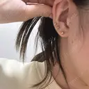 糸リフト MKクリニック 日本橋院 DAY 6 サムネイル用