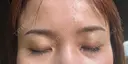 アートメイク（眉） 表参道メディカルクリニック 広島院 DAY 6 サムネイル用