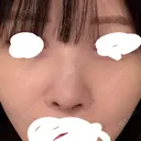 鼻中隔延長（切開） / その他（鼻） / 軟骨移植 / 鼻孔縁下降 / 鼻柱下降・鼻唇角形成（猫手術） KIHARU CLINIC DAY 9 サムネイル用