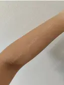 白玉点滴・注射 城本クリニック 大阪院 DAY 1 サムネイル用