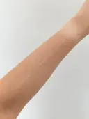 白玉点滴・注射 城本クリニック 大阪院 AFTER サムネイル用