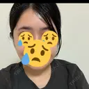 骨切り（あご） / 骨削り（エラ） / 骨削り（頬） リッツ美容外科 東京院 DAY 18 サムネイル用