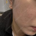 ポテンツァ ルラ美容クリニック 岐阜院 AFTER サムネイル用