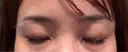 アートメイク（眉） 表参道メディカルクリニック 広島院 DAY 9 サムネイル用