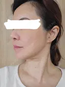 美容点滴・美容注射（美肌） / 美容点滴・美容注射（疲労回復） / ピーリング（ニキビ・毛穴） / イオン導入 / エレクトロポレーション / ピーリング（ハリ・ツヤ） oneUPclinic DAY 1 サムネイル用