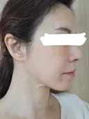 美容点滴・美容注射（美肌） / 美容点滴・美容注射（疲労回復） / ピーリング（ニキビ・毛穴） / イオン導入 / エレクトロポレーション / ピーリング（ハリ・ツヤ） oneUPclinic DAY 1 サムネイル用