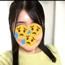 骨切り（あご） / 骨削り（エラ） / 骨削り（頬） リッツ美容外科 東京院 DAY 22 サムネイル用