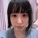 糸リフト MKクリニック 日本橋院 AFTER サムネイル用