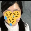 骨切り（あご） / 骨削り（エラ） / 骨削り（頬） リッツ美容外科 東京院 DAY 26 サムネイル用