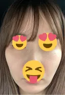 ピーリング（ハリ・ツヤ） / ピコスポット ビューティー和心クリニック 浅草院 DAY 9 サムネイル用