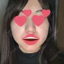 オンダリフト LIGHT CLINIC 【ライトクリニック】 名古屋院 DAY 0 サムネイル用