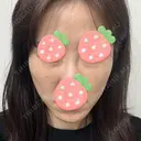 ボトックス（あご） / ヒアルロン酸注入（頬） ルラ美容クリニック 池袋院 AFTER サムネイル用