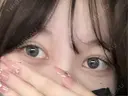 二重埋没 / 目頭切開 / 上まぶたの脂肪取り アリエル美容クリニック 郡山院 DAY 93 サムネイル用