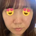 毛穴洗浄（ハイドラフェイシャルなど） DAILY SKIN CLINIC 心斎橋院 DAY 0 サムネイル用