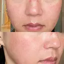 ヴェルヴェットスキン RainBoW Clinic TOKYO DAY 0 サムネイル用