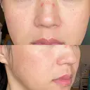 ヴェルヴェットスキン RainBoW Clinic TOKYO DAY 1 サムネイル用