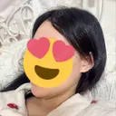 脂肪吸引（顔） / ネックリフト リラ・クラニオフェイシャル・クリニック DAY 12 サムネイル用