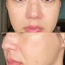 ヴェルヴェットスキン RainBoW Clinic TOKYO DAY 3 サムネイル用