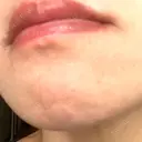 ヴェルヴェットスキン RainBoW Clinic TOKYO DAY 3 サムネイル用