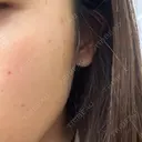 ルメッカ おおかみ美容のクリニック 新宿院 DAY 0 サムネイル用