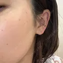 ルメッカ おおかみ美容のクリニック 新宿院 DAY 1 サムネイル用