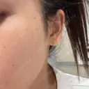 ルメッカ おおかみ美容のクリニック 新宿院 DAY 3 サムネイル用