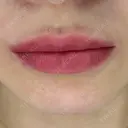 アートメイク（唇） 岸上歯科クリニック AFTER サムネイル用