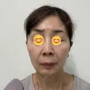ポテンツァ BAO CLINIC 神戸院 DAY 2 サムネイル用