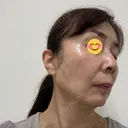 ポテンツァ BAO CLINIC 神戸院 DAY 2 サムネイル用