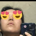 鼻尖形成（切開） / 小鼻縮小（切開） / 脂肪吸引（顔） / 軟骨移植 / 骨切幅寄せ / 鼻尖縮小 / 鼻柱挙上 銀座マイアミ美容外科 DAY 713 サムネイル用