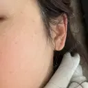 ルメッカ おおかみ美容のクリニック 新宿院 AFTER サムネイル用