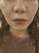 その他 MKクリニック 日本橋院 DAY 0 サムネイル用