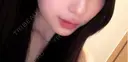ヒアルロン酸注入（唇） / ボトックス（口角） / RF（高周波）たるみ治療 ルラ美容クリニック 京都院 AFTER サムネイル用