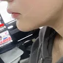 ジョールファット除去 札幌美容外科ネビュラクリニック DAY 15 サムネイル用